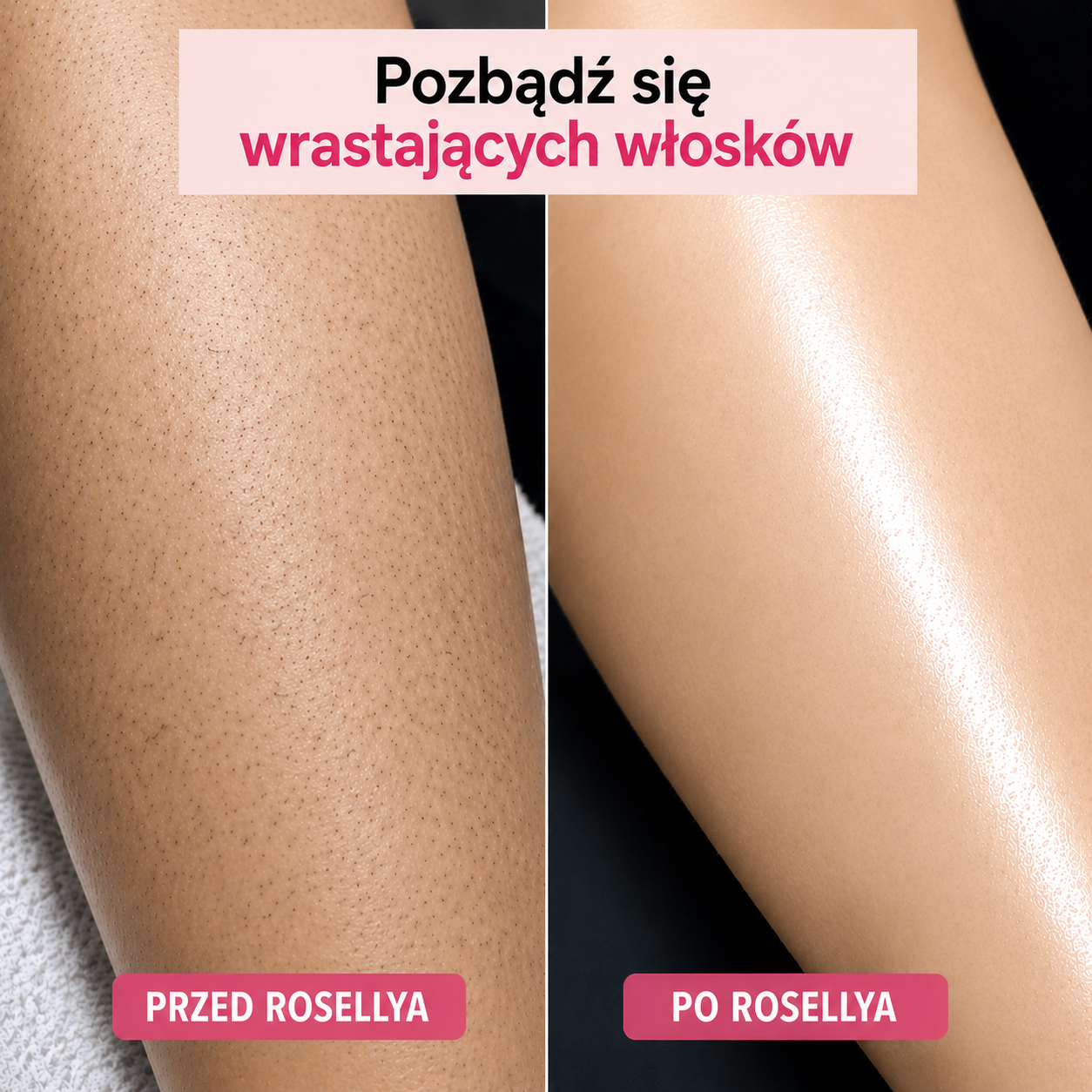 Golarka Rosellya®-thumbmail-4