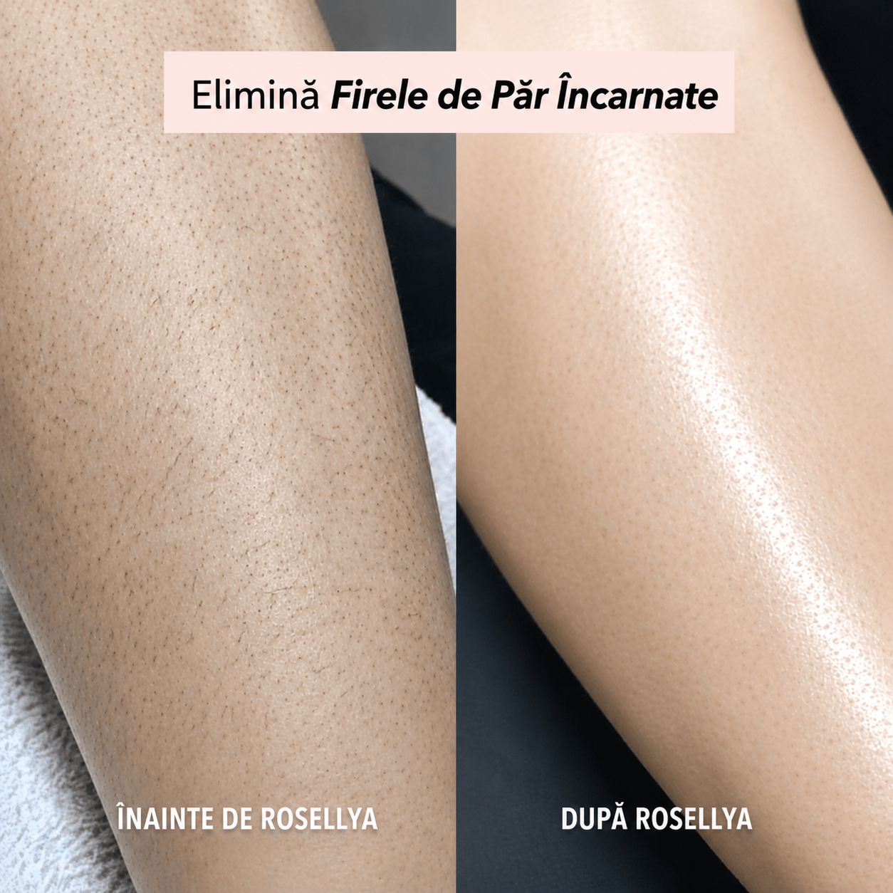 Aparat de ras Rosellya®-thumbmail-4