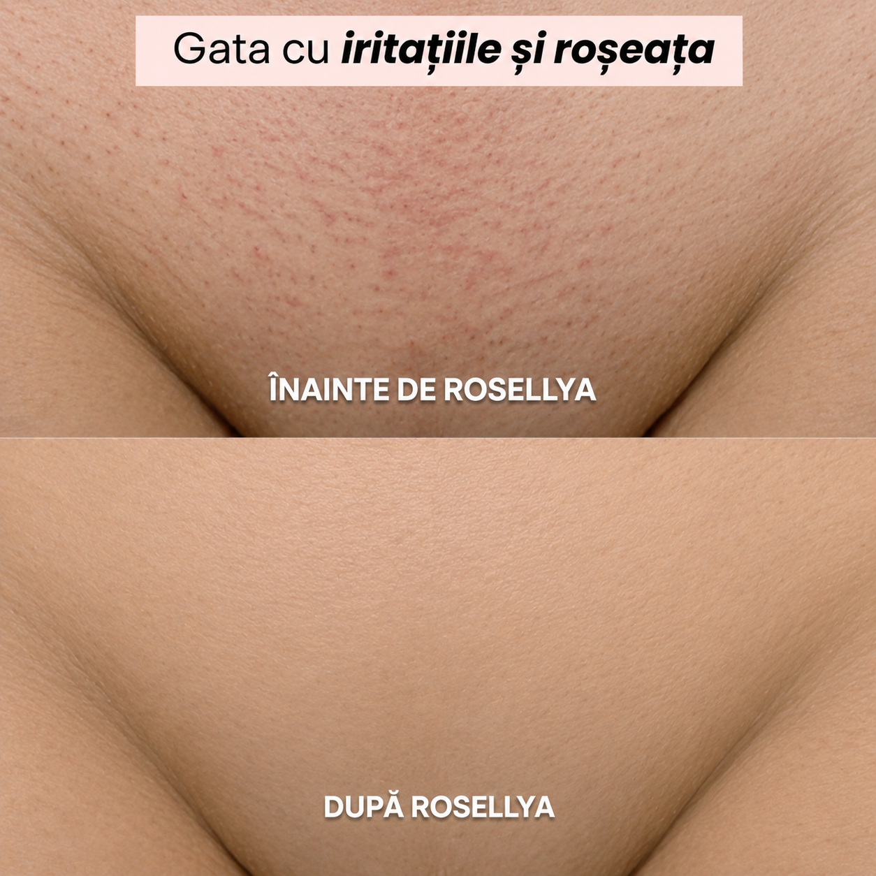 Aparat de ras Rosellya®-thumbmail-5
