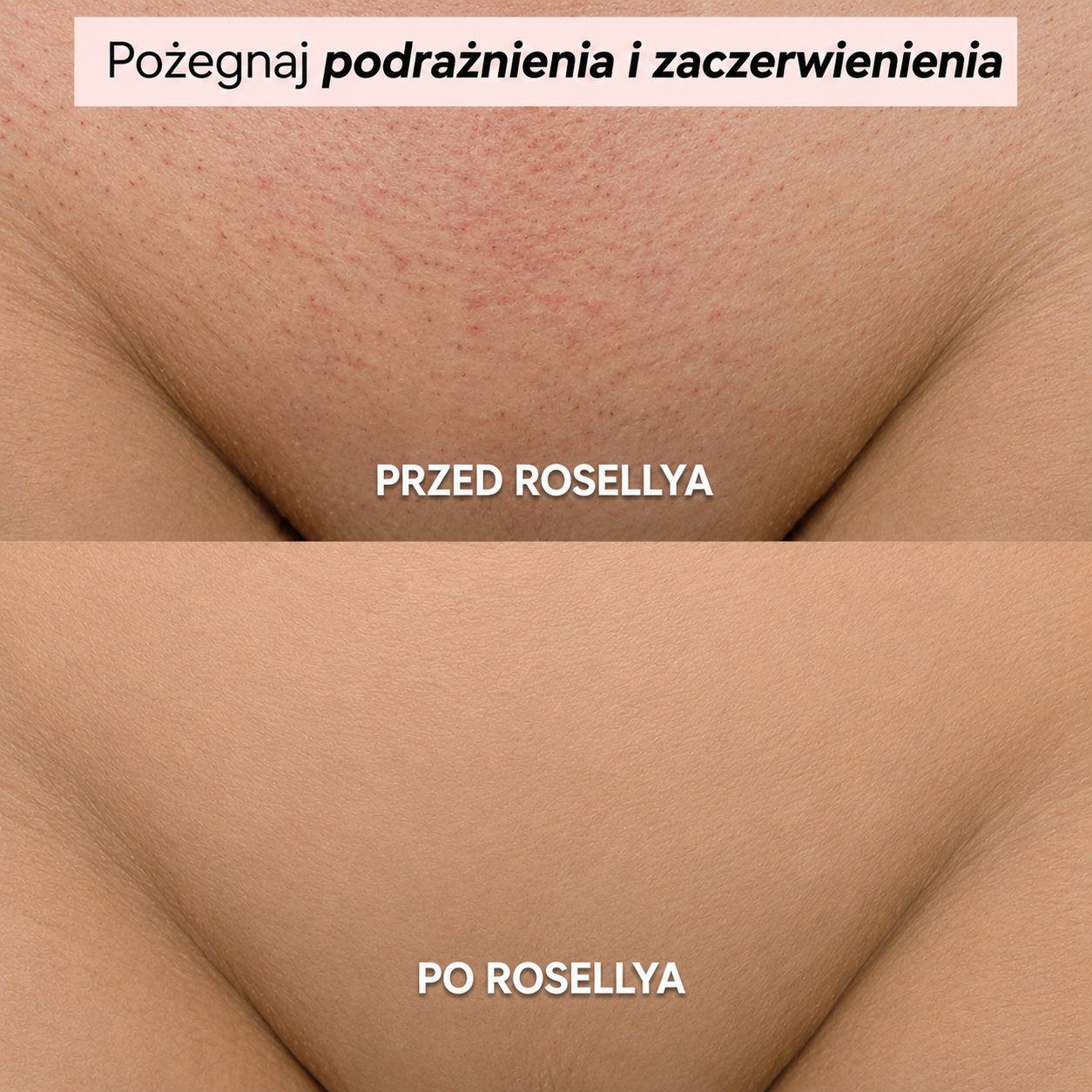Golarka Rosellya®-thumbmail-6